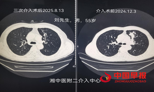 1762340116250604.png 图片1.png